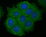 P2X7 Antibody in Immunocytochemistry (ICC/IF)