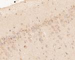 P2X7 Antibody in Immunohistochemistry (Paraffin) (IHC (P))