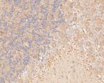 P2X7 Antibody in Immunohistochemistry (Paraffin) (IHC (P))