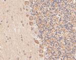 KCNMA1 Antibody in Immunohistochemistry (Paraffin) (IHC (P))