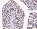 DNMT3A Antibody in Immunohistochemistry (Paraffin) (IHC (P))