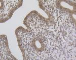 ERN1 Antibody in Immunohistochemistry (Paraffin) (IHC (P))