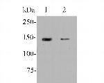 ERN1 Antibody in Western Blot (WB)