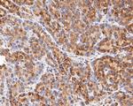 SAP97 Antibody in Immunohistochemistry (Paraffin) (IHC (P))