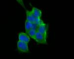 Flt3 Antibody in Immunocytochemistry (ICC/IF)