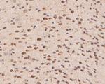 Flt3 Antibody in Immunohistochemistry (Paraffin) (IHC (P))