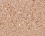 EPHA2 Antibody in Immunohistochemistry (Paraffin) (IHC (P))