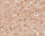 EPHA2 Antibody in Immunohistochemistry (Paraffin) (IHC (P))