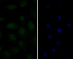 Androgen Receptor Antibody in Immunocytochemistry (ICC/IF)