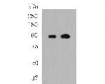 Androgen Receptor Antibody in Western Blot (WB)