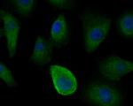 IRS1 Antibody in Immunocytochemistry (ICC/IF)