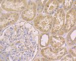 IRS1 Antibody in Immunohistochemistry (Paraffin) (IHC (P))