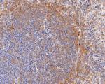 CD28 Antibody in Immunohistochemistry (Paraffin) (IHC (P))