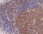 CD28 Antibody in Immunohistochemistry (Paraffin) (IHC (P))