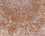 CD28 Antibody in Immunohistochemistry (Paraffin) (IHC (P))