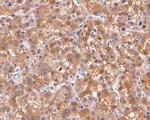 CBR1 Antibody in Immunohistochemistry (Paraffin) (IHC (P))