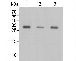 CBR1 Antibody in Western Blot (WB)