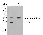 TREM2 Antibody in Western Blot (WB)