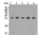 PSMA5 Antibody in Western Blot (WB)