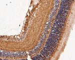 GRK1 Antibody in Immunohistochemistry (Paraffin) (IHC (P))