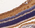 GRK1 Antibody in Immunohistochemistry (Paraffin) (IHC (P))