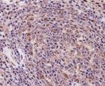 TLR7 Antibody in Immunohistochemistry (Paraffin) (IHC (P))