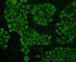 Topoisomerase II alpha Antibody in Immunocytochemistry (ICC/IF)