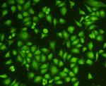 Topoisomerase II alpha Antibody in Immunocytochemistry (ICC/IF)