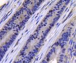 Topoisomerase II alpha Antibody in Immunohistochemistry (Paraffin) (IHC (P))