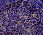 Topoisomerase II alpha Antibody in Immunohistochemistry (Paraffin) (IHC (P))