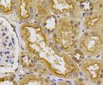 VEGFR1 Antibody in Immunohistochemistry (Paraffin) (IHC (P))