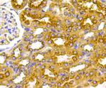 VEGFR1 Antibody in Immunohistochemistry (Paraffin) (IHC (P))