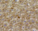 VEGFR1 Antibody in Immunohistochemistry (Paraffin) (IHC (P))