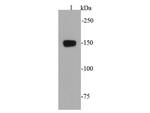 VEGFR1 Antibody in Western Blot (WB)