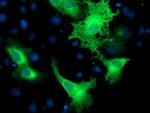 ERBB2 Antibody in Immunocytochemistry (ICC/IF)