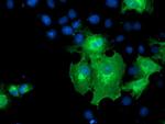 ERBB2 Antibody in Immunocytochemistry (ICC/IF)