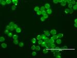 ERBB2 Antibody in Immunocytochemistry (ICC/IF)