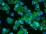 ERBB2 Antibody in Immunocytochemistry (ICC/IF)