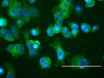 ERBB2 Antibody in Immunocytochemistry (ICC/IF)