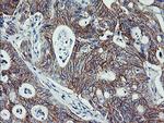 ERBB2 Antibody in Immunohistochemistry (Paraffin) (IHC (P))