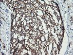 ERBB2 Antibody in Immunohistochemistry (Paraffin) (IHC (P))