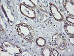 ERBB2 Antibody in Immunohistochemistry (Paraffin) (IHC (P))