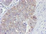 ERBB2 Antibody in Immunohistochemistry (Paraffin) (IHC (P))