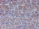 ERBB2 Antibody in Immunohistochemistry (Paraffin) (IHC (P))