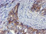 ERBB2 Antibody in Immunohistochemistry (Paraffin) (IHC (P))