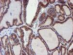 ERBB2 Antibody in Immunohistochemistry (Paraffin) (IHC (P))