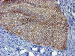 ERBB2 Antibody in Immunohistochemistry (Paraffin) (IHC (P))