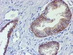 ERBB2 Antibody in Immunohistochemistry (Paraffin) (IHC (P))