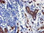 ERBB2 Antibody in Immunohistochemistry (Paraffin) (IHC (P))