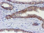 ERBB2 Antibody in Immunohistochemistry (Paraffin) (IHC (P))